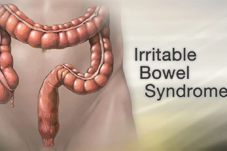 Irritable Bowel Syndrome: Causes & Symptoms