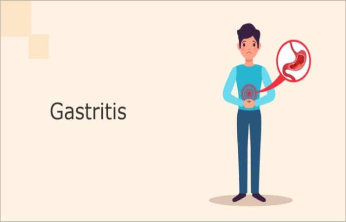 gastritis