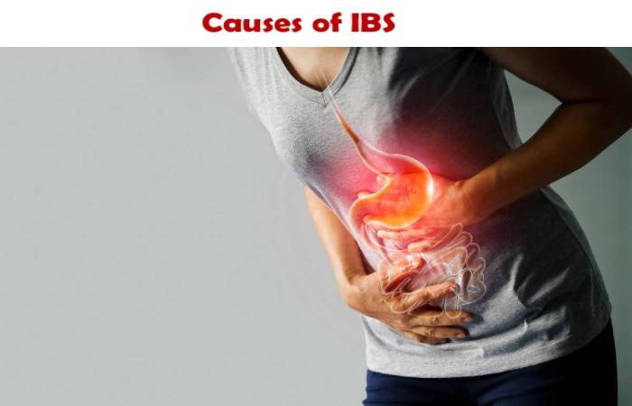 irritable bowel syndrome