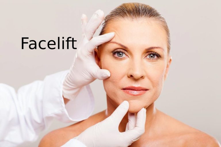 Thinking About a Facelift? Key Things to Know