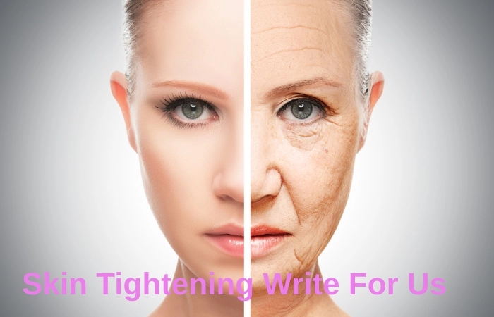 Skin Tightening Write For Us