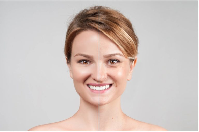 How Stem Cell Skincare Can Help as an Anti-Aging Treatment